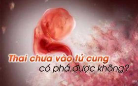 thai-chua-vao-tu-cung-co-pha-duoc-khong