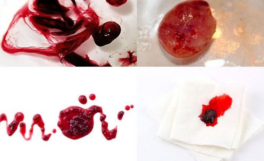 dau-hieu-say-thai-2-tuan-dau-chi-em-can-nam-ro